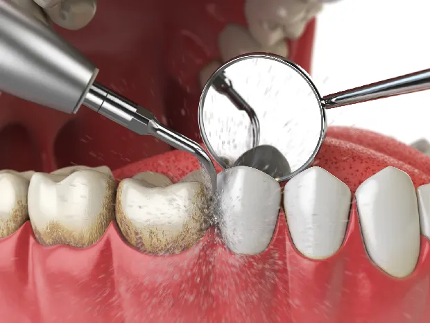 zęby z bliska w trakcie badania dentystycznego